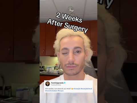 #FrankieGrande reveals his new nose after undergoing surgery. (🎥: TT) #shorts