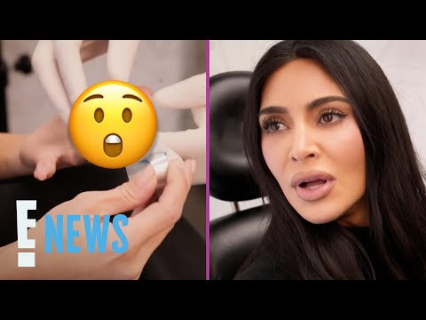 See Kim Kardashian's Shocking Hand Injury That Was "Worse Than Childbirth" | E! News