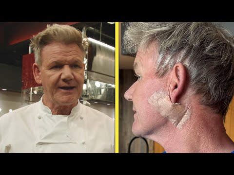 Gordon Ramsay Reveals Skin Cancer Diagnosis